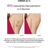 Ulike Air3 Plus purple IPL-Haarentferner